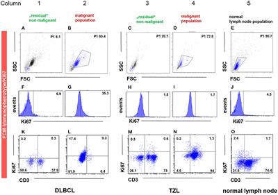 Flow Cytometric Assessment of Ki-67 Expression in Lymphocytes From Physiologic Lymph Nodes, Lymphoma Cell Populations and Remnant Normal Cell Populations From Lymphomatous Lymph Nodes